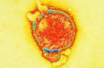 New Hendra Virus Case In Rockhampton